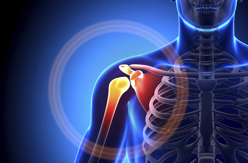 How To Protect Yourself From Shoulder Injuries If You Are A Wheelchair User